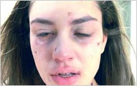 Anti-Meth-PSA