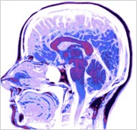Brain-Scan-B